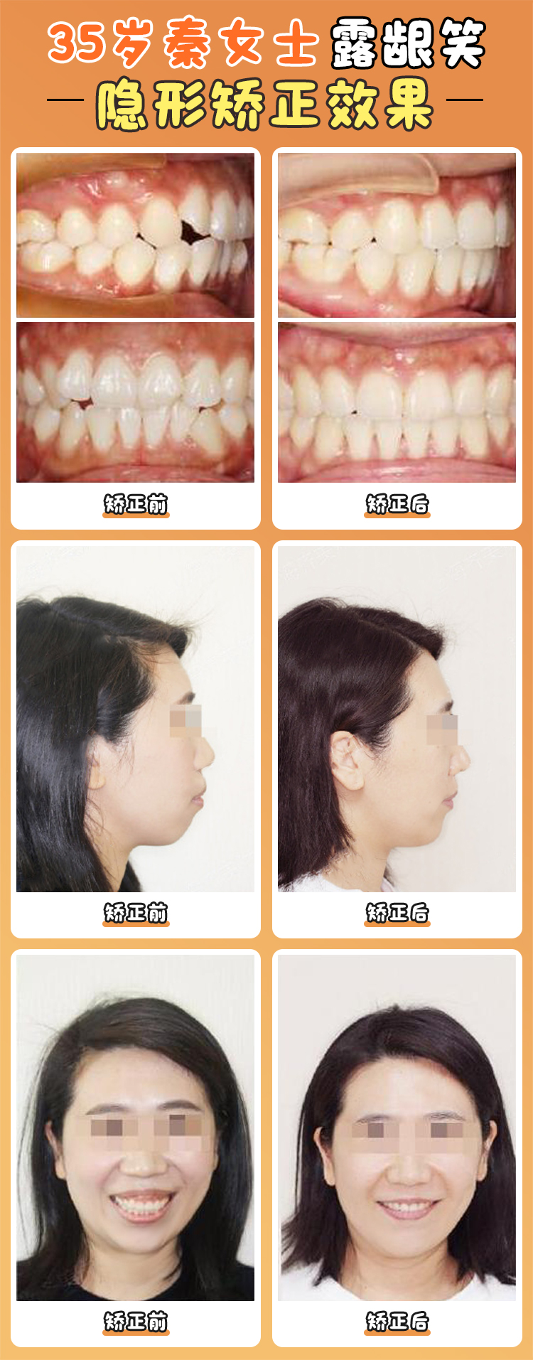 徐寶華年齡與經(jīng)驗積淀：30年正畸生涯的匠心傳承