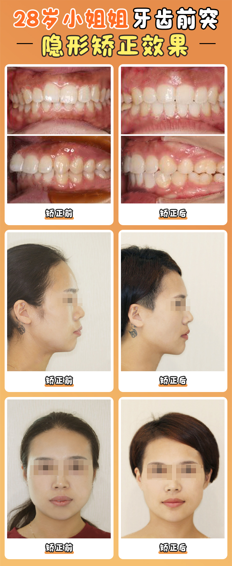 周傳麗正畸技術(shù)怎么樣？從“牙齒排齊”到“面型管理”的全維度矯治哲學(xué)