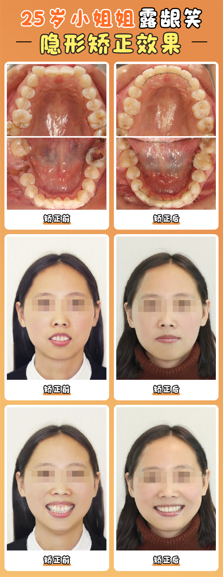 Part 2:北大口腔贾培增医生:不止是“矫正大师”,更是“学术大牛”