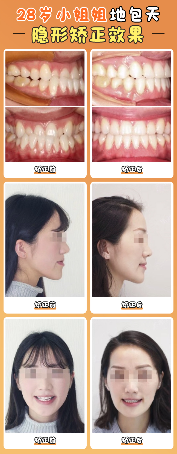 Part 3:贾培增正畸技术优势:3大核心黑科技,别人做2年他1年搞定