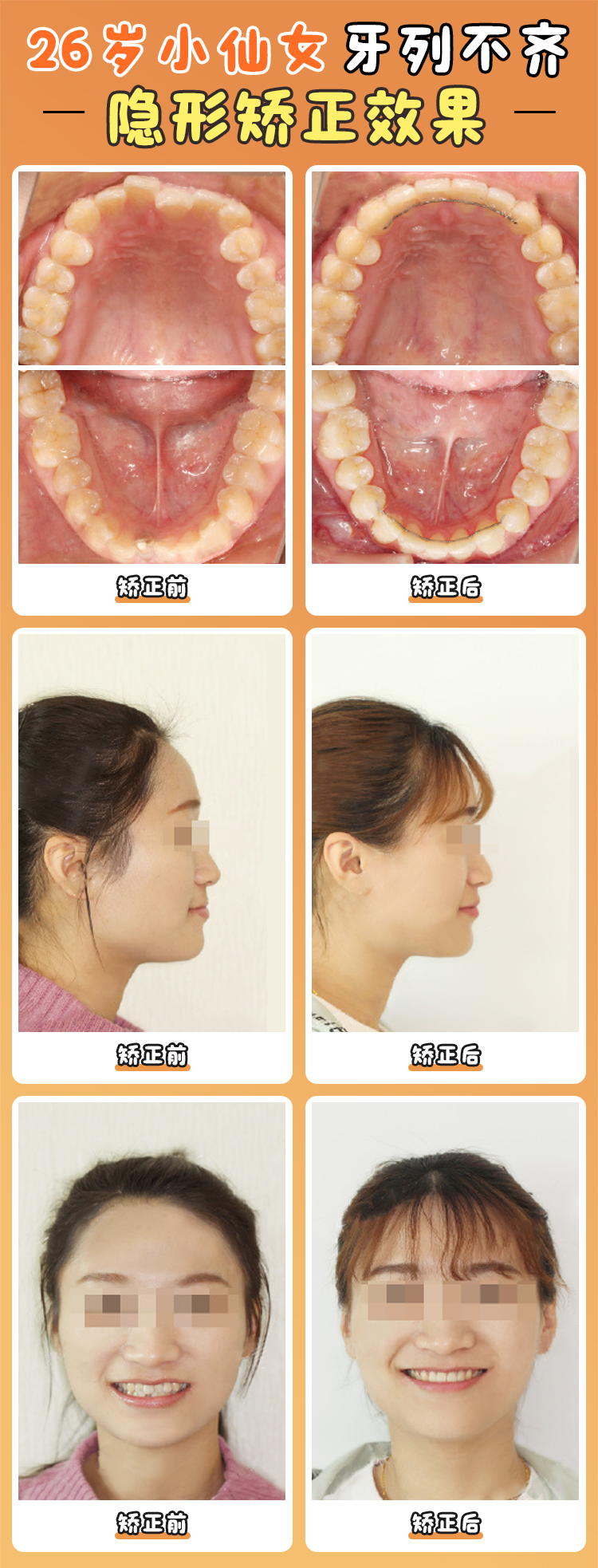 北大口腔醫(yī)院江久匯掛號(hào)攻略：破解“一號(hào)難求”的實(shí)戰(zhàn)技巧