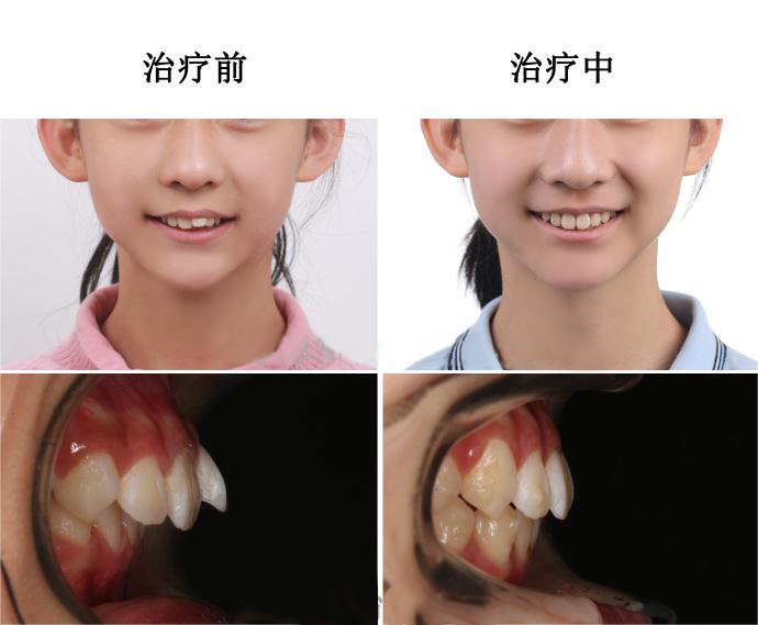 江久匯北大口腔學(xué)術(shù)成就與行業(yè)貢獻(xiàn)：推動(dòng)正畸領(lǐng)域發(fā)展的領(lǐng)跑人