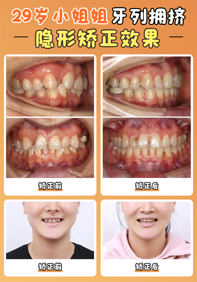 五、张栋梁医生预约攻略：抢号堪比春运？这3招让你秒约！