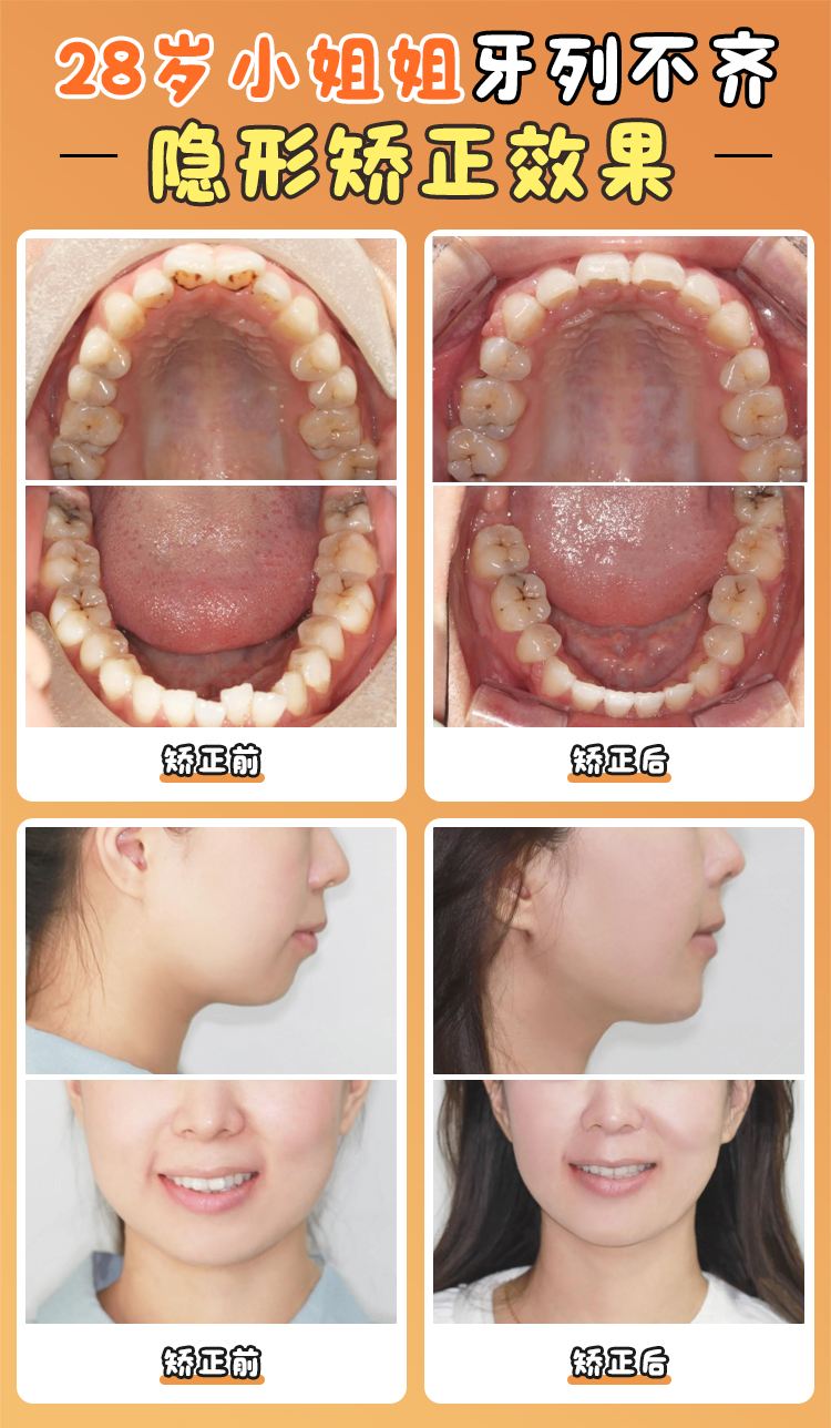 徐寶華掛號攻略：國有/私立雙渠道預約技巧大公開