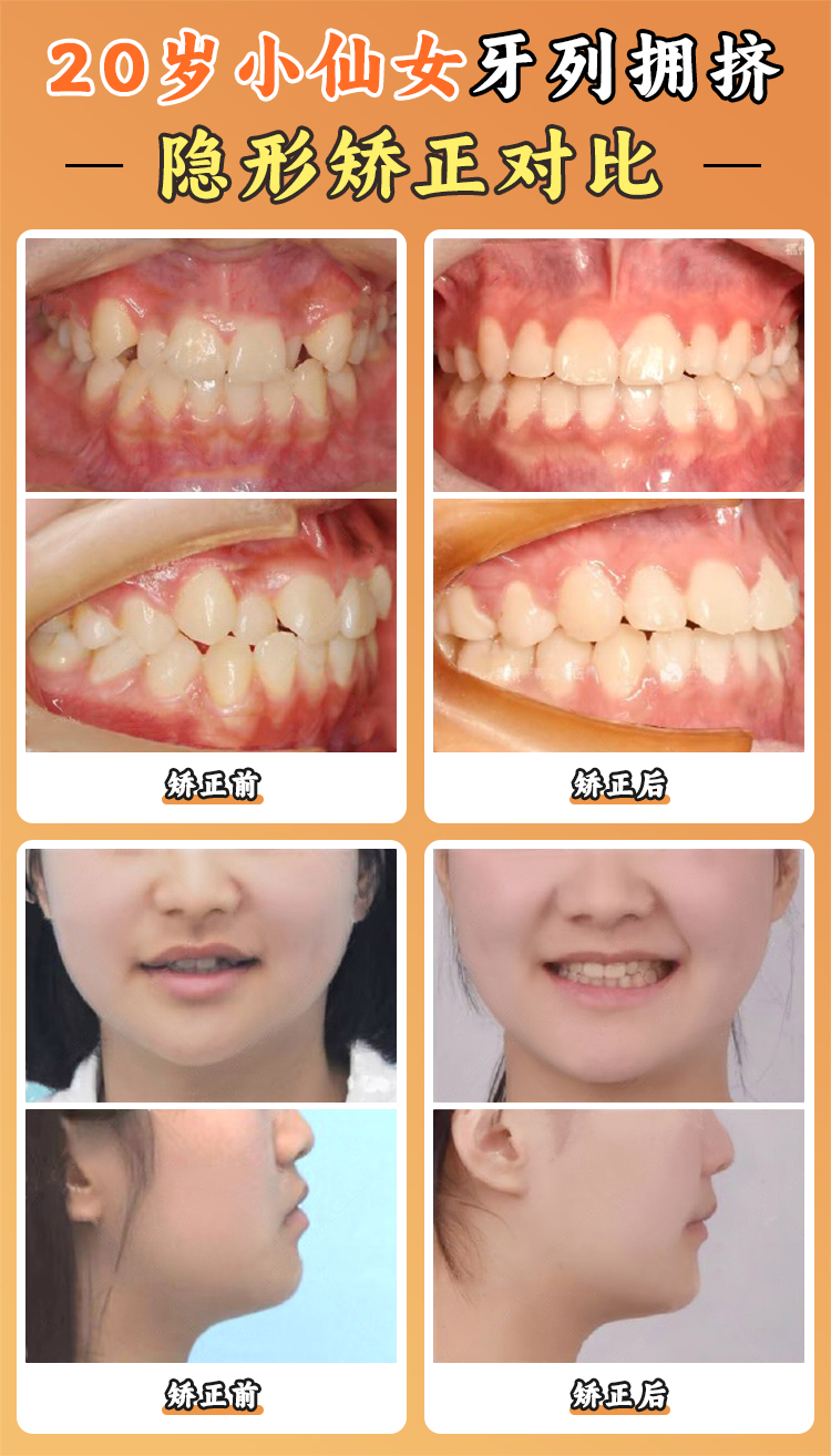 三、周彥恒正畸怎么那么貴？?jī)r(jià)格構(gòu)成與市場(chǎng)定位揭秘