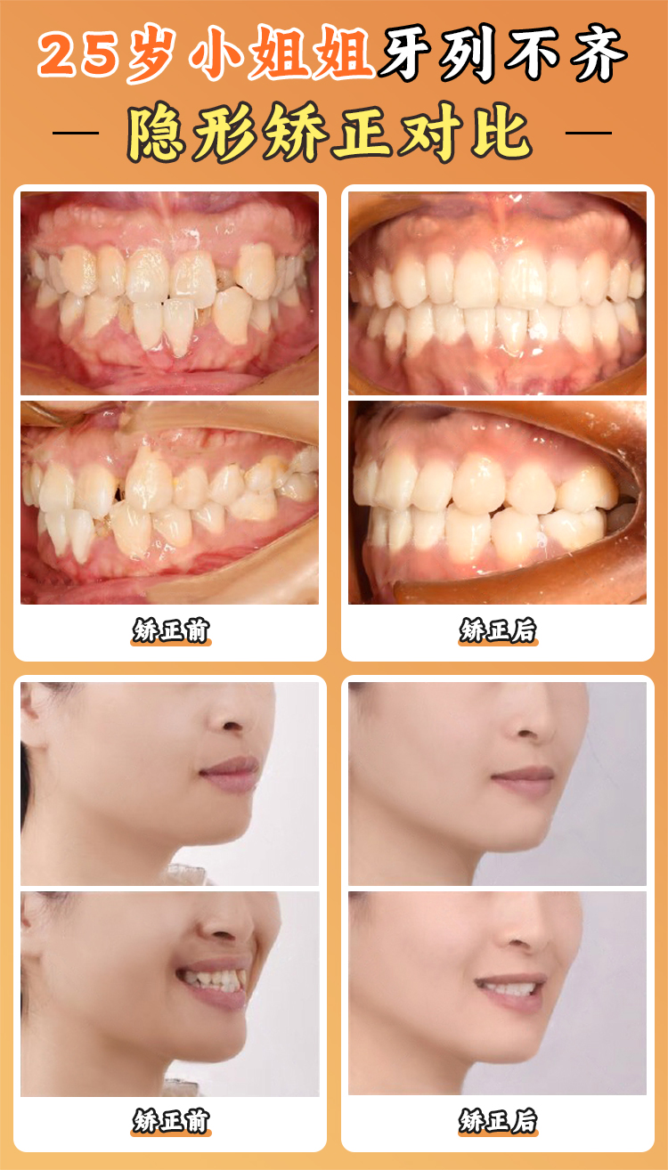 四、周彥恒正畸實(shí)例庫(kù)：成功與爭(zhēng)議實(shí)例的細(xì)節(jié)對(duì)比