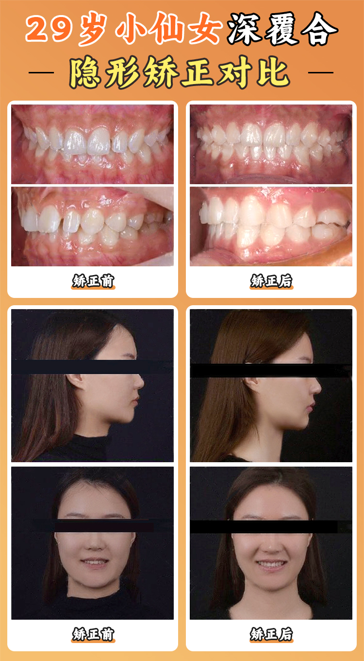 五、周彥恒正畸預(yù)約掛號(hào)全攻略：避坑指南與渠道對(duì)比