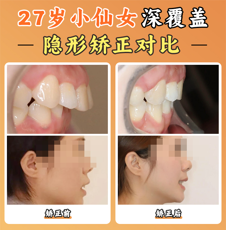 八、周彥恒整牙失敗爭(zhēng)議總結(jié)：理性選擇正畸醫(yī)生的三大標(biāo)準(zhǔn)