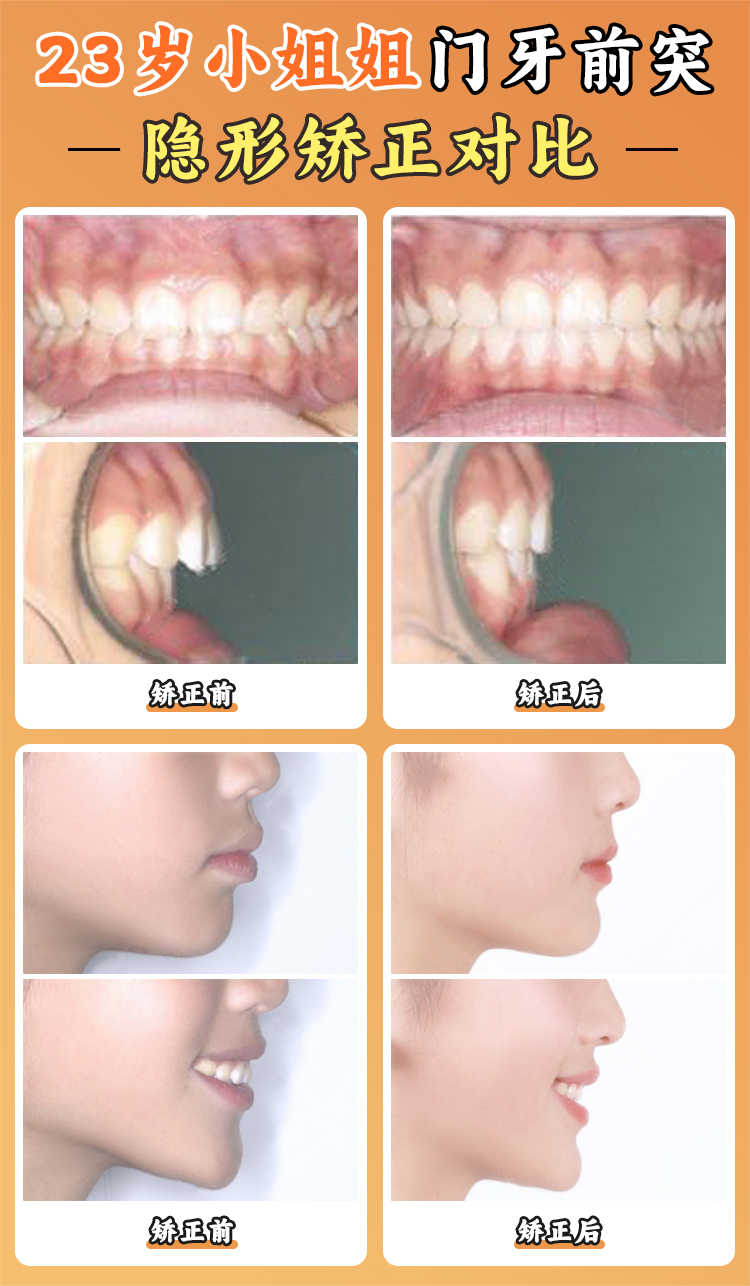 北大口腔江久匯怎么樣？三等甲醫(yī)院平臺的技術(shù)賦能與資源優(yōu)勢