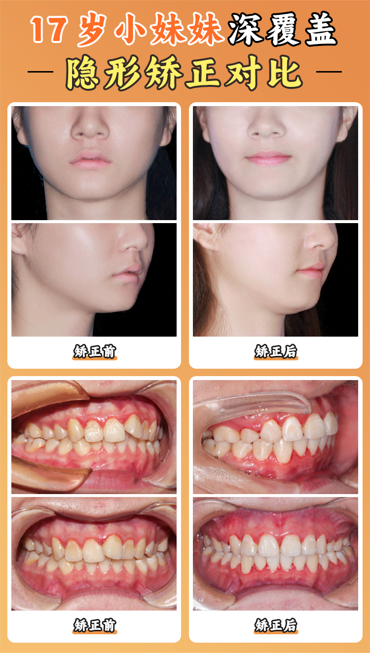 江久匯正畸口碑怎么樣？2025年真實患者評價大數(shù)據(jù)分析