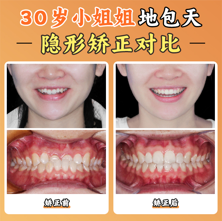 江久匯醫(yī)生怎么掛號？2025年全新預約攻略與渠道對比