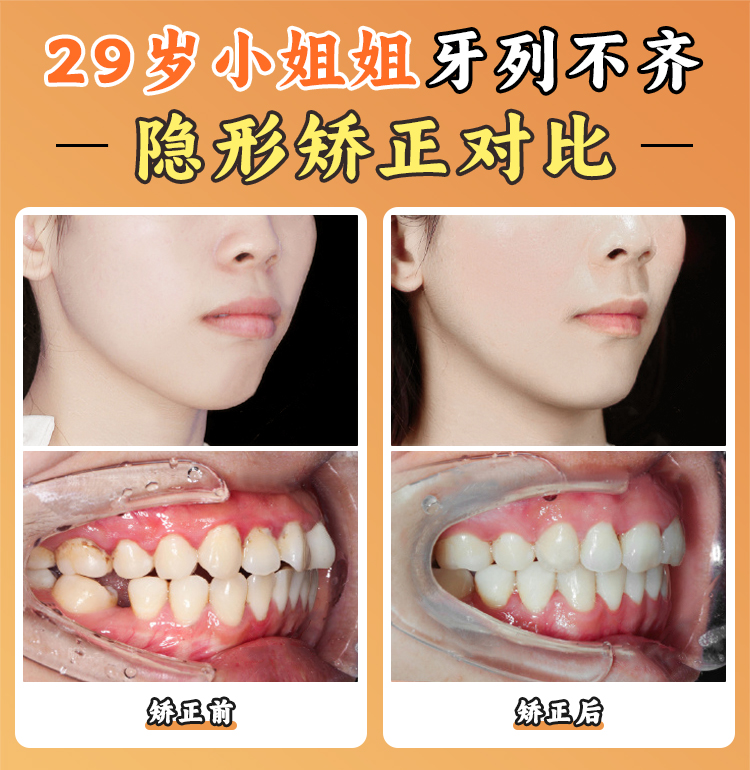 江久匯正畸是雜牌還是品牌？行業(yè)地位與學術(shù)影響力解讀