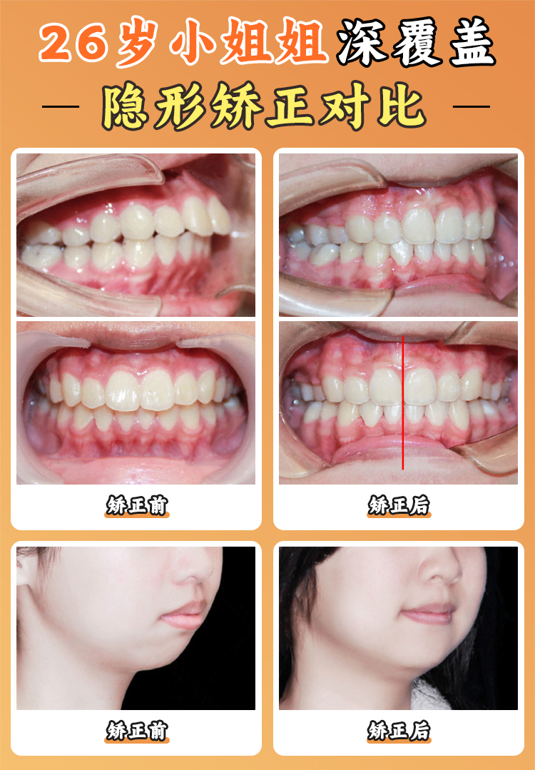 北京大學(xué)口腔醫(yī)院王碩技術(shù)特色：數(shù)字化正畸如何實(shí)現(xiàn)精細(xì)效率高？