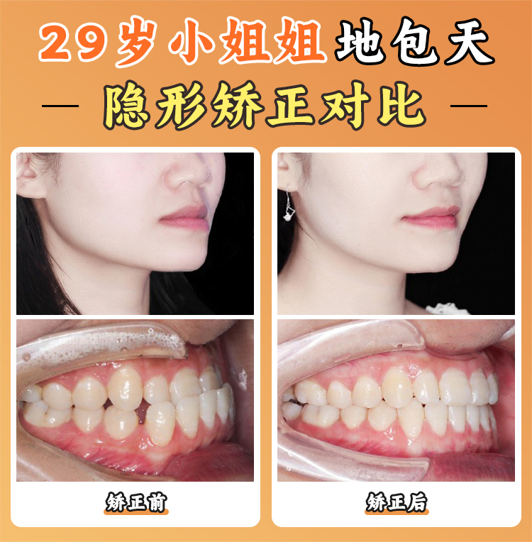 北京大學(xué)口腔醫(yī)院王碩擅長項(xiàng)目：從常規(guī)矯正到復(fù)雜病例的全方面覆蓋