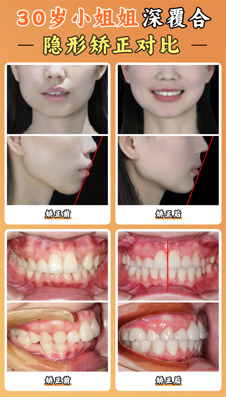 北京大學(xué)口腔醫(yī)院王碩科研實(shí)力：從臨床問題到專項(xiàng)成果的轉(zhuǎn)化之路