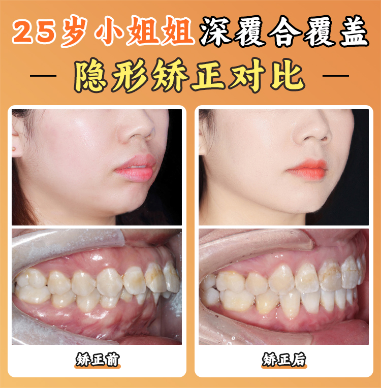 北京大學(xué)口腔醫(yī)院王碩患者口碑：真實(shí)實(shí)例見證技術(shù)與服務(wù)雙重優(yōu)勢