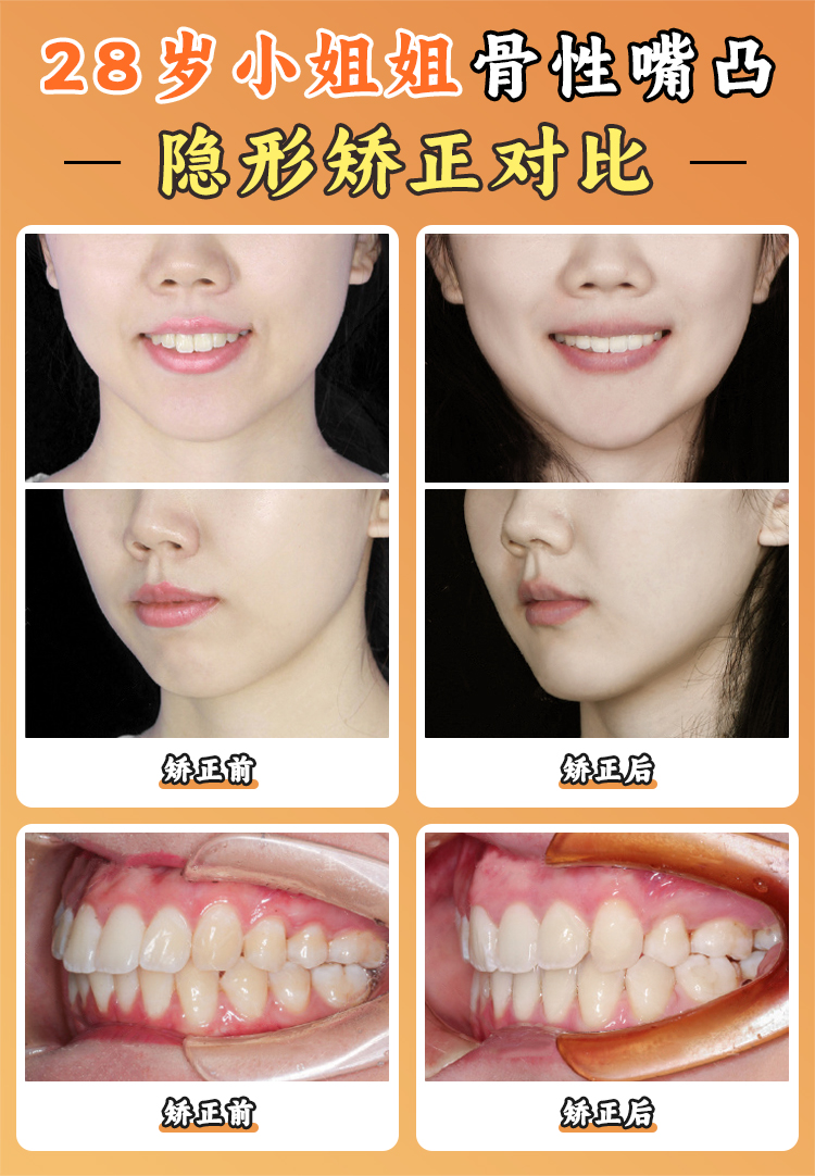 北京大學(xué)口腔醫(yī)院王碩收費(fèi)標(biāo)準(zhǔn)：透明化定價(jià)體系與性價(jià)比解析