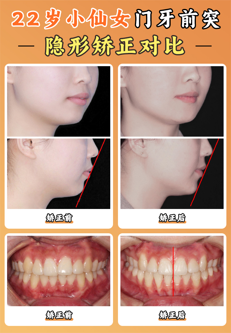 北京大學(xué)口腔醫(yī)院王碩預(yù)約指南：三步輕松掛號，避坑攻略大公開