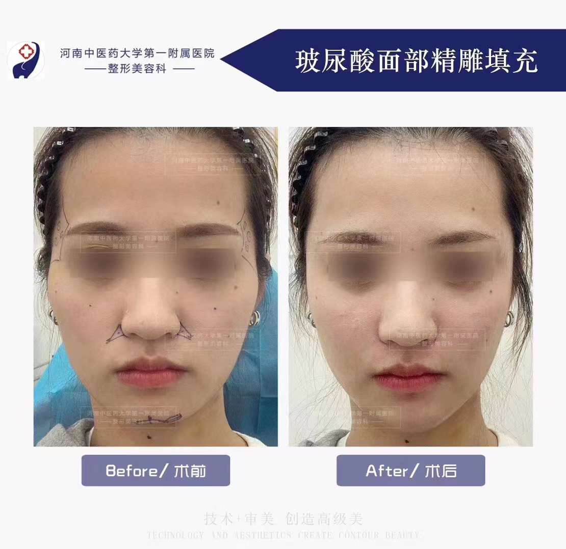 周彥恒鄭州坐診能解決哪些矯正難題？這些“老大難”問題他都擅長