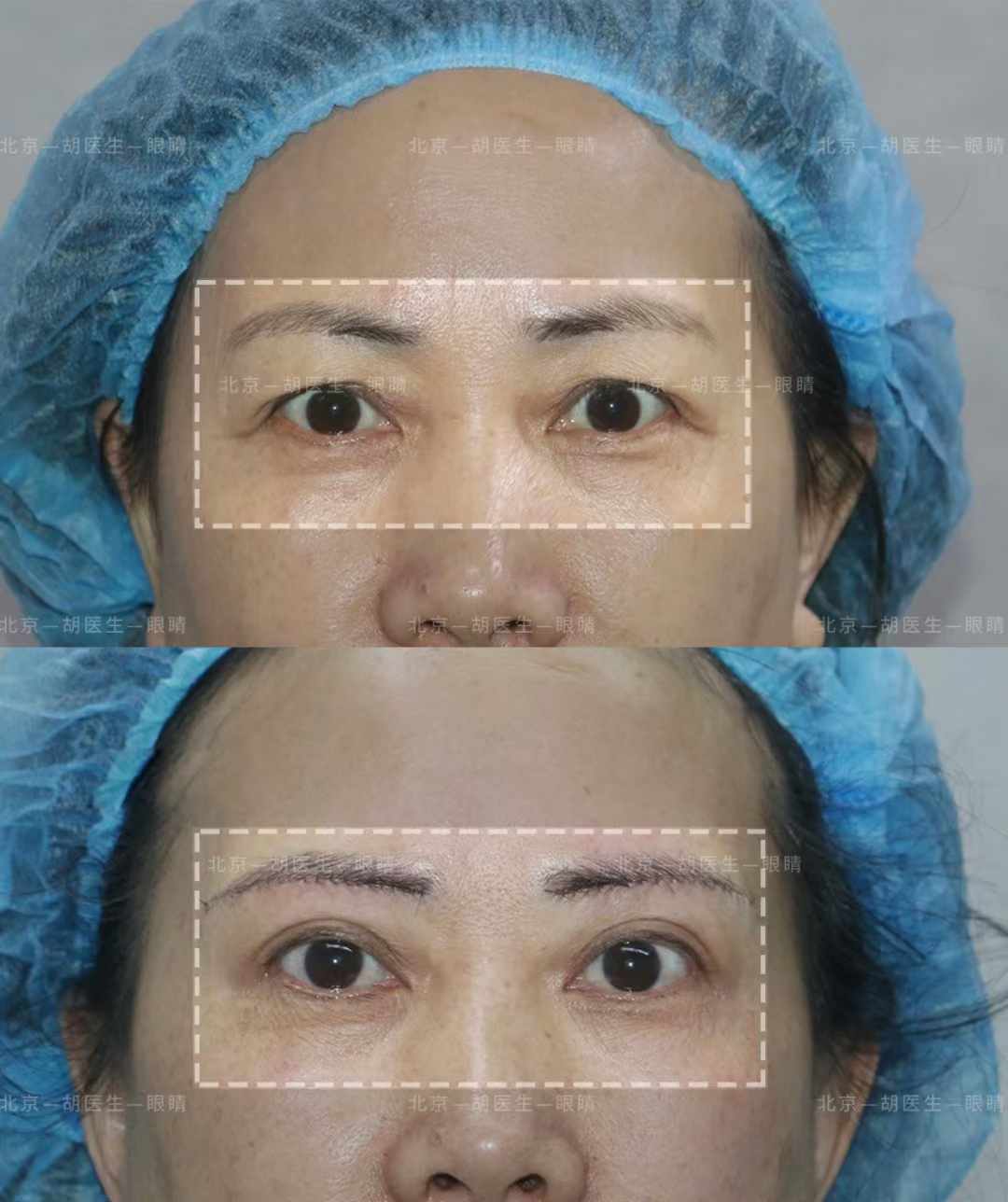 北京口腔醫(yī)院王鵬醫(yī)生出診院區(qū)與掛號指南：微信支付寶小程序預(yù)約全流程