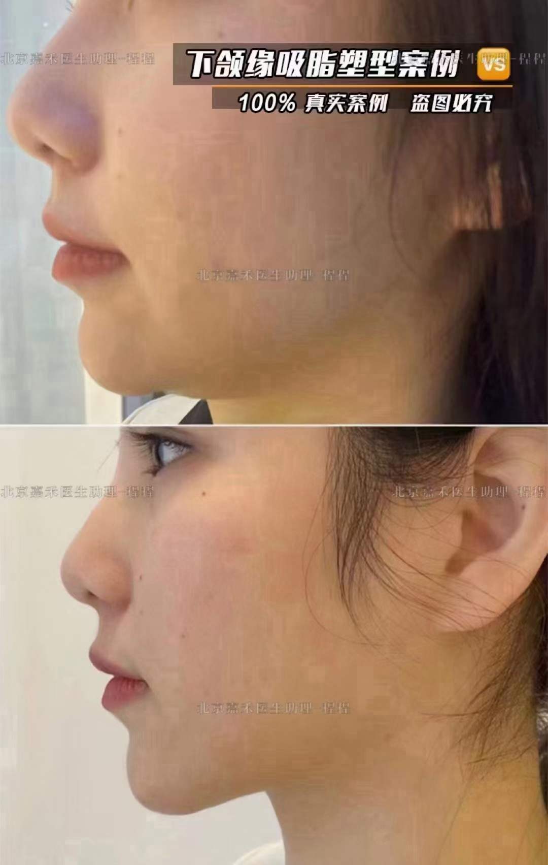 北京口腔醫(yī)院王鵬醫(yī)生患者口碑與臨床反饋：20年診療經(jīng)驗(yàn)積累的真實(shí)評價(jià)