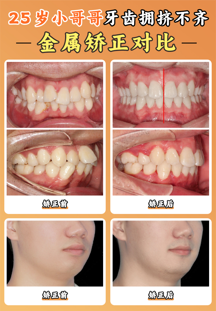 周傳麗口腔技術(shù)實力解析：隱適美認(rèn)證骨干醫(yī)生的三大核心優(yōu)勢