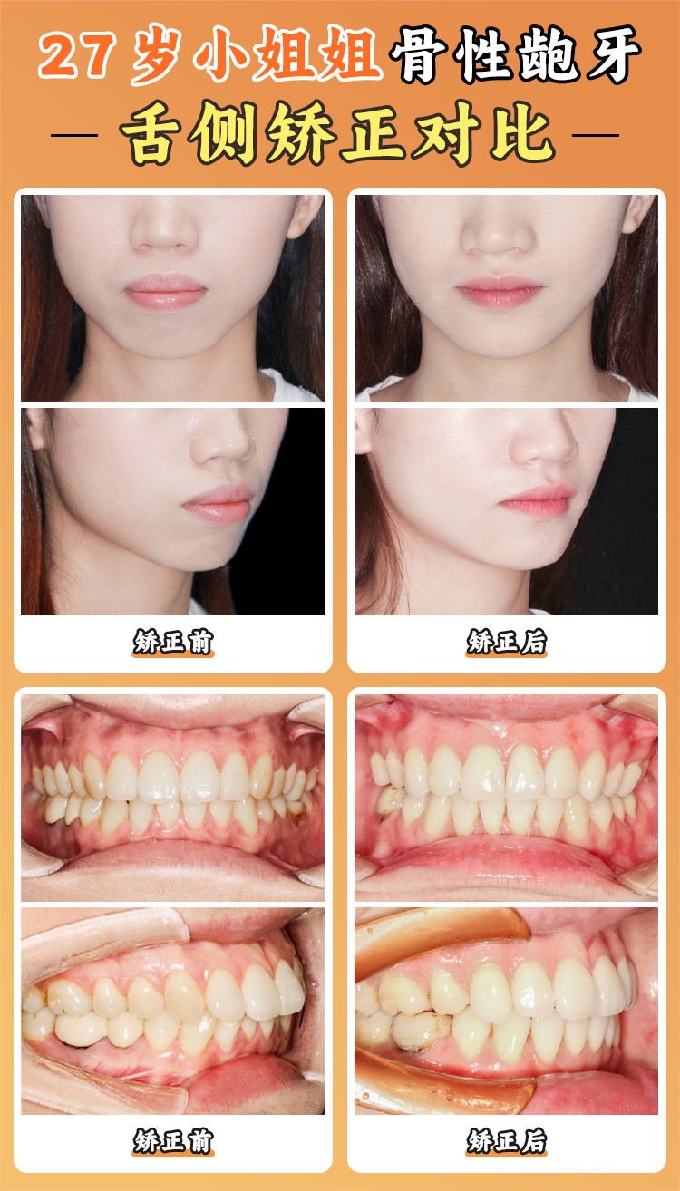 周傳麗醫(yī)生工作室口碑實錄：從兒童到成人的全齡段正畸方案