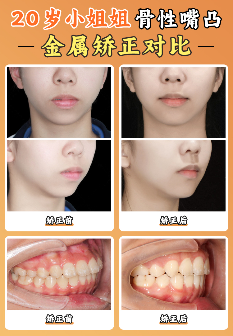 張棟梁醫(yī)生工作室技術(shù)實(shí)力大起底：12項(xiàng)專項(xiàng)如何改寫正畸規(guī)則？