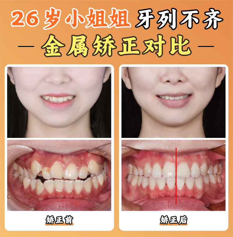 張棟梁醫(yī)生工作室預(yù)約攻略：3大渠道告別“一號(hào)難求”