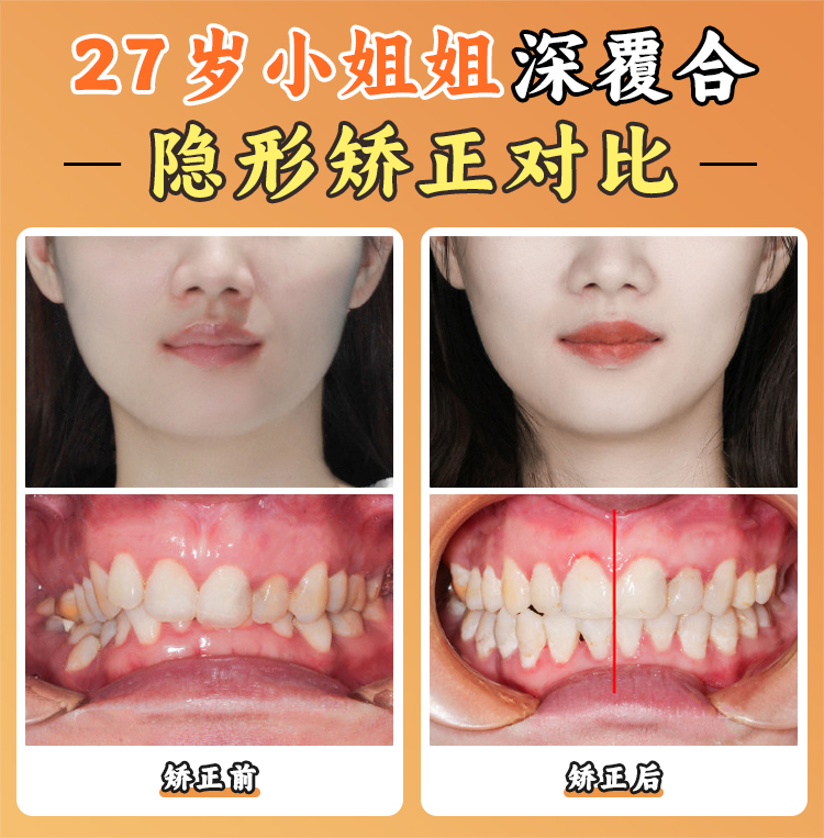 張棟梁醫(yī)生工作室患者真實(shí)評(píng)價(jià)：這些正畸“黑科技”太圈粉！