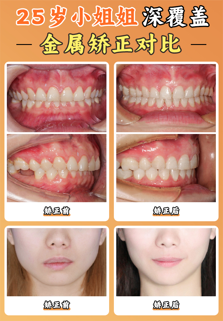 周彦恒牙医西安正畸技术深度解析:从“骨性错颌”到“微笑美学”,他的技术为何被称为“教科书级”?