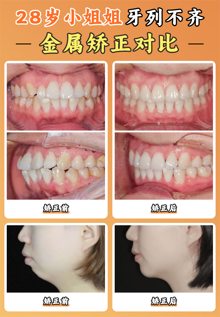 周彦恒牙医西安坐诊医院揭秘:高新赛德阳光/医学校二院双院区,哪家更适合你?