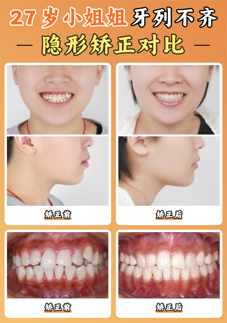 周彦恒牙医西安预约攻略:北大口腔骨干医生号难抢?西安挂号通道及注意事项!