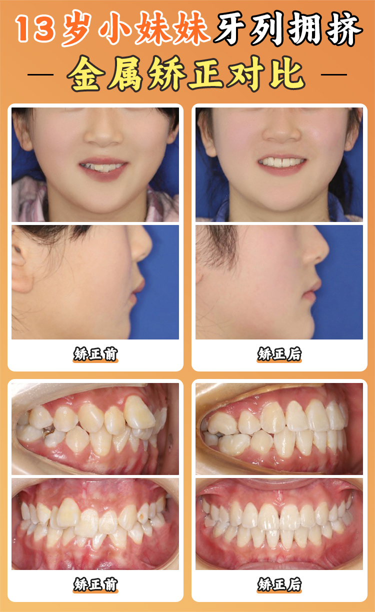 周彦恒牙医西安口碑真相:患者口中的“严师型骨干医生”,技术与服务如何兼得?