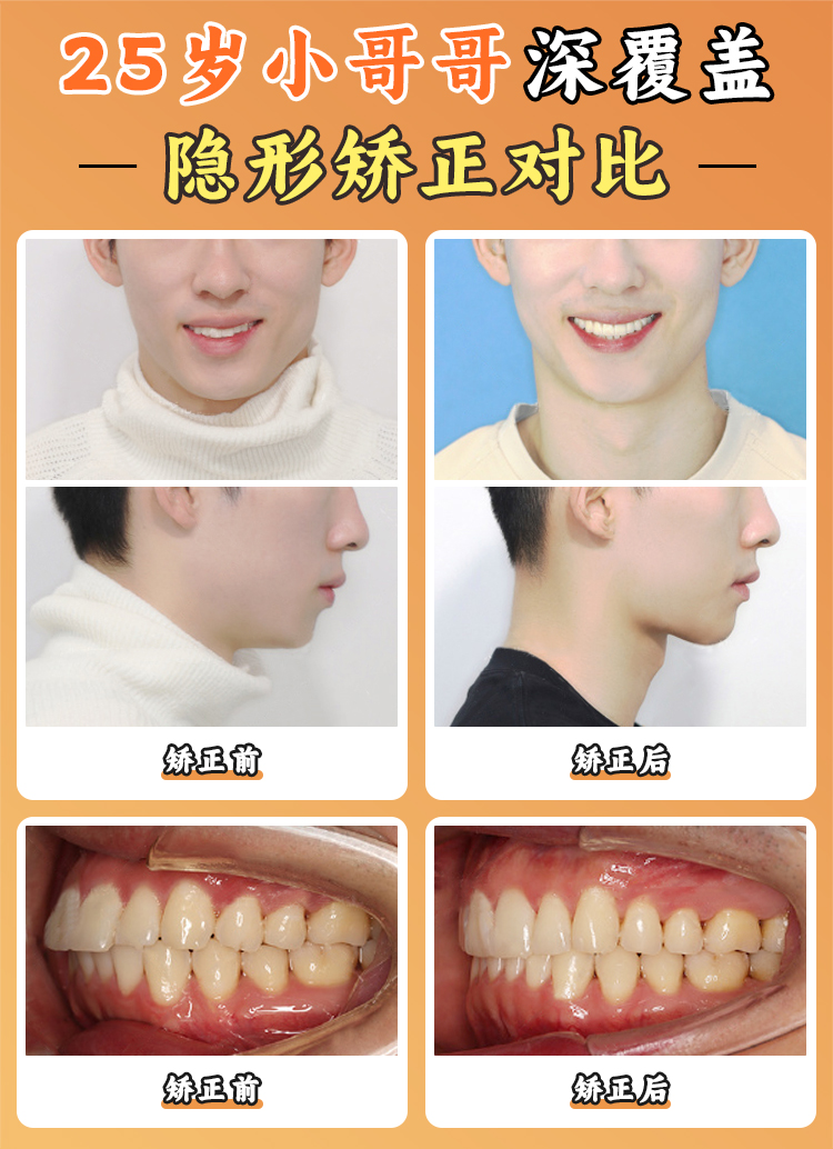 二、徐寶華醫(yī)生組合項(xiàng)目?jī)r(jià)格表