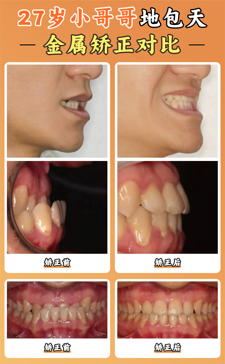 三、徐寶華醫(yī)生核心技術(shù)價(jià)格對(duì)比