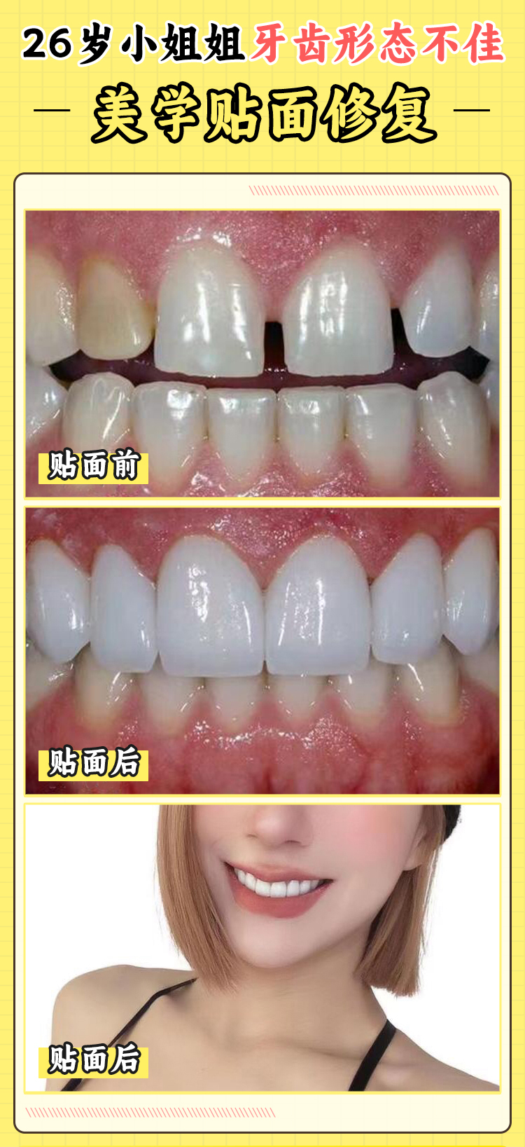 周彥恒和張棟梁誰厲害？細究隱適美與不拔牙矯正技術(shù)口碑及坐診醫(yī)院情況