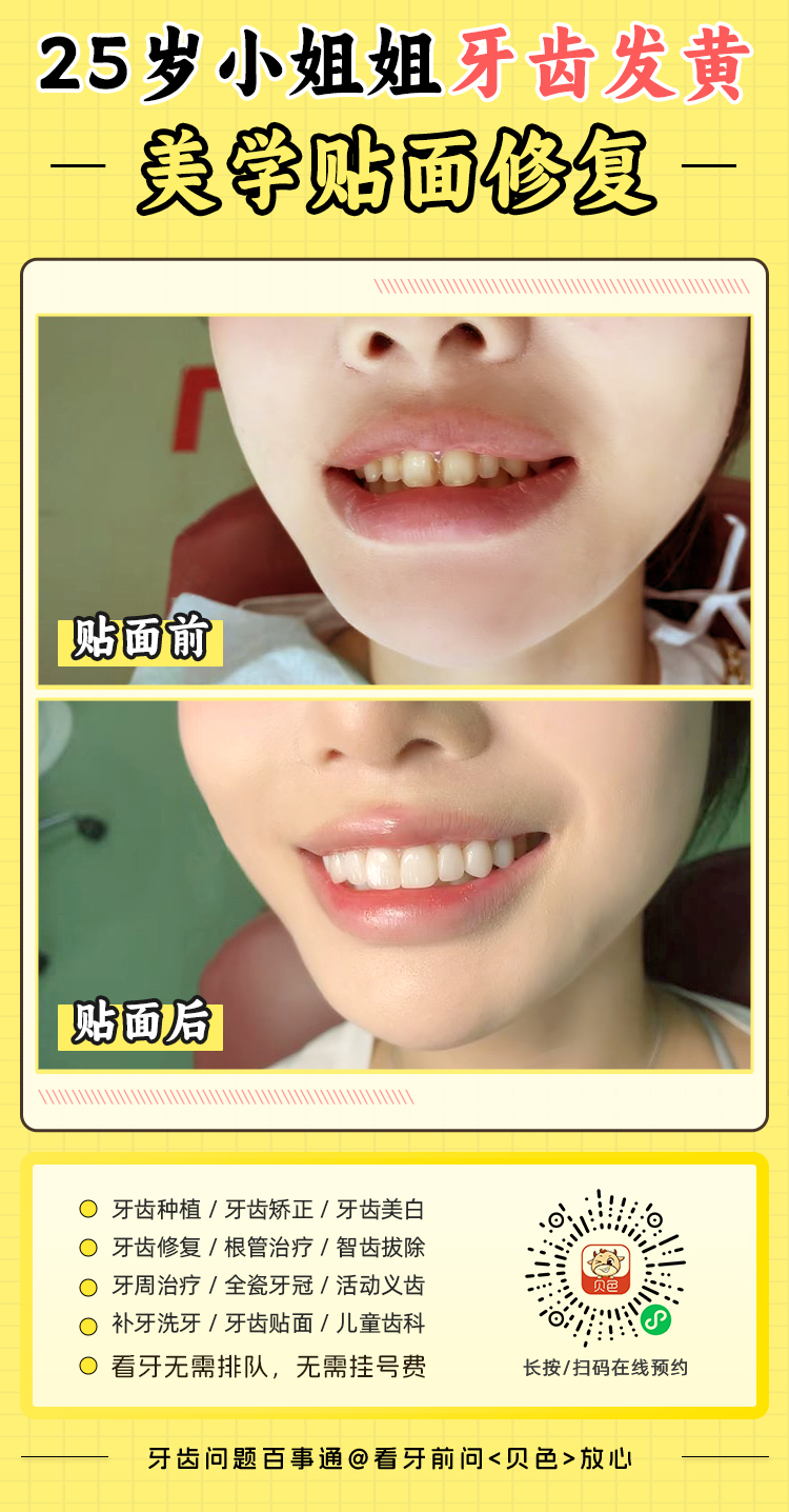 正畸費用大比拼：周彥恒與張棟梁收費標(biāo)準(zhǔn)及性價比分析