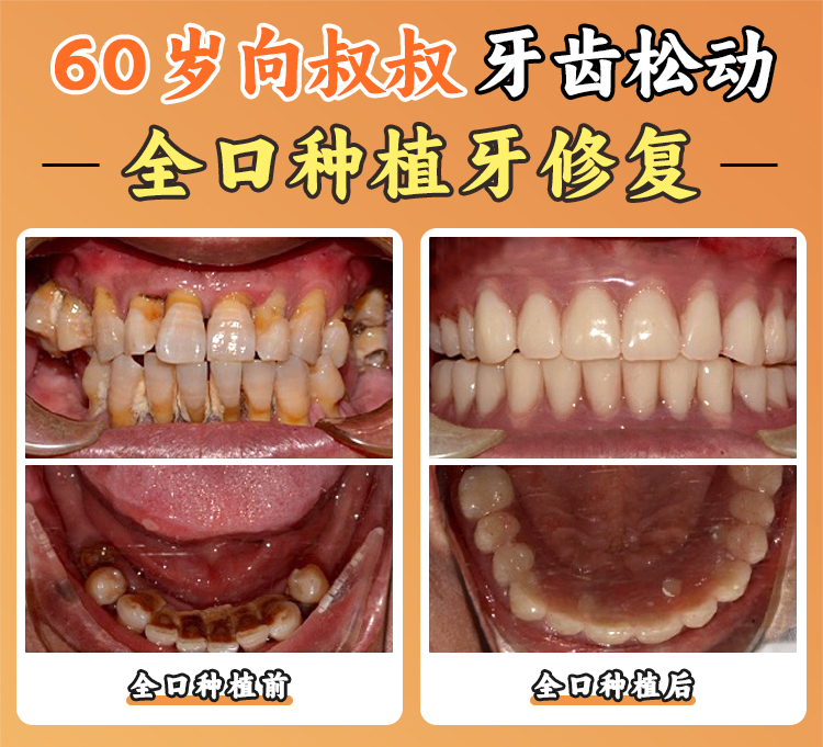 預(yù)約攻略：如何成功掛號周彥恒和張棟梁？骨干醫(yī)生號搶奪指南
