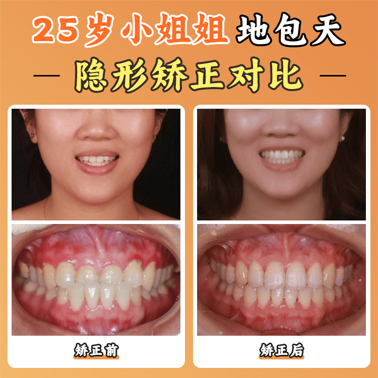 三、周彦恒医生不同技术价格对比