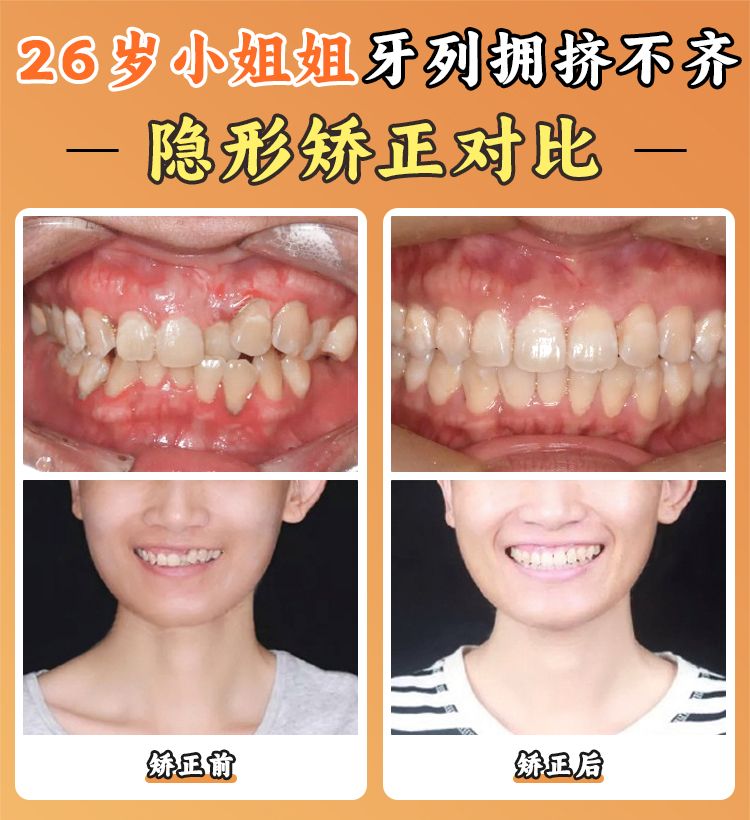 七、周彦恒医生预约挂号方式和注意事项