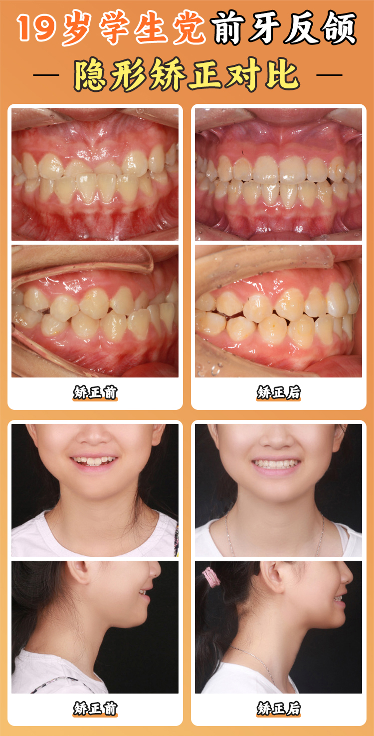 徐寶華正畸掛號費多少？國有特需vs私立免掛號費對比