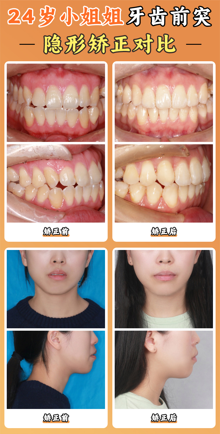 徐寶華正畸掛號常見問題：上海有分院嗎？能加號嗎？