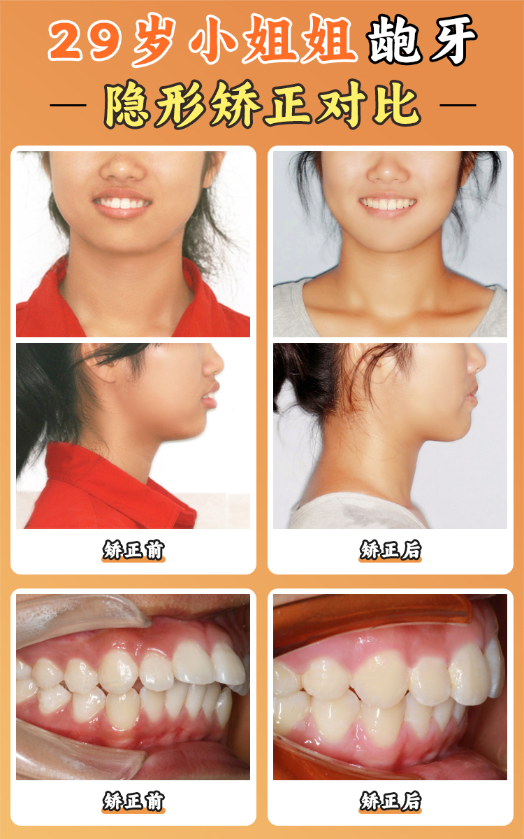 徐寶華正畸掛號總結(jié)：3步效率高預(yù)約法