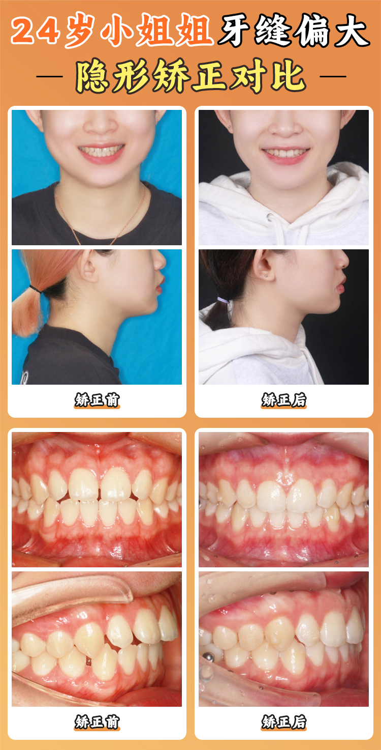想掛周彥恒的號？法定預約渠道與避坑指南全盤點