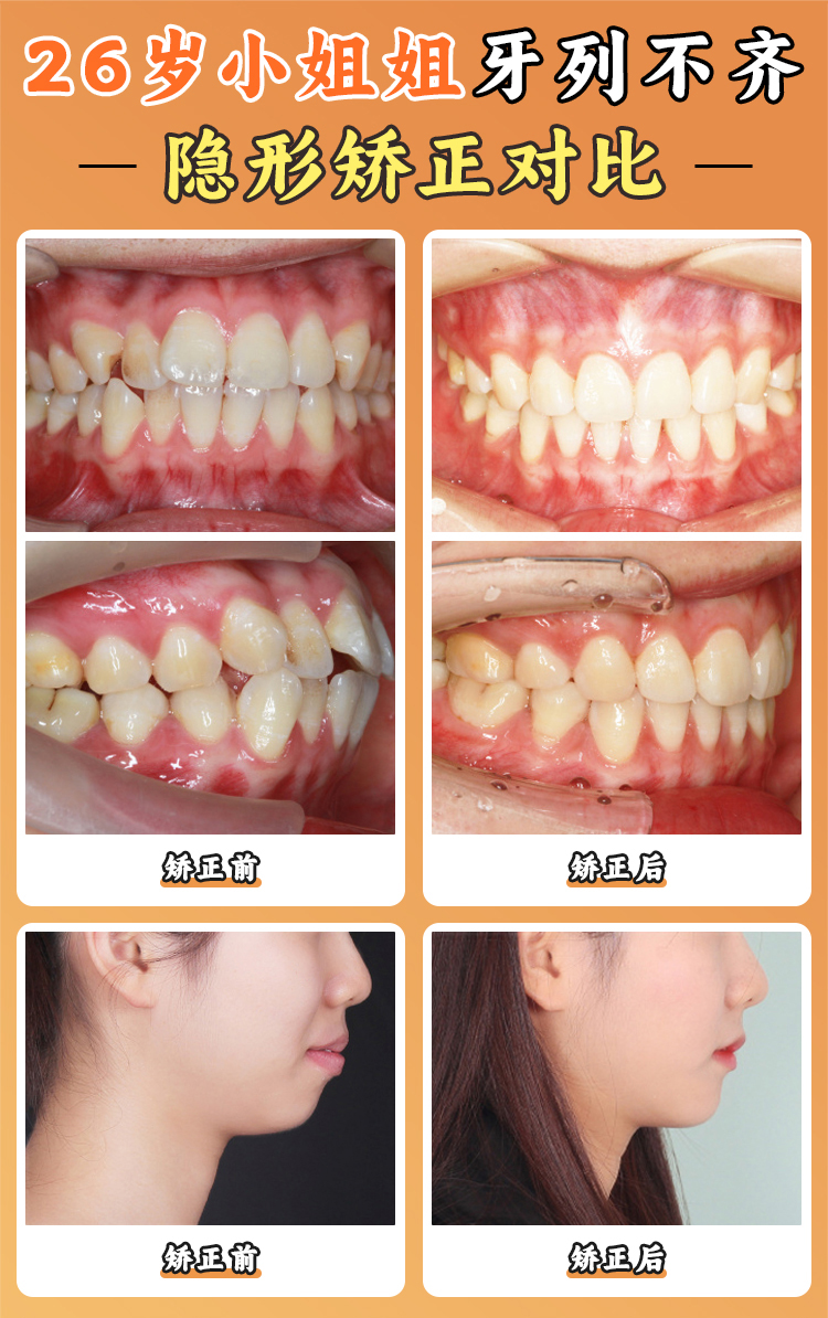 周傳麗出診時(shí)間已明確，探尋周傳麗教授醫(yī)生工作室數(shù)字化正畸3大創(chuàng)新突破奧秘