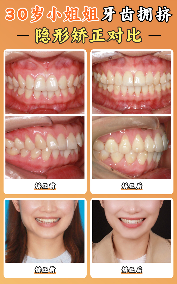 周傳麗口腔正畸專長領(lǐng)域：從青少年到成人的全周期矯治方案