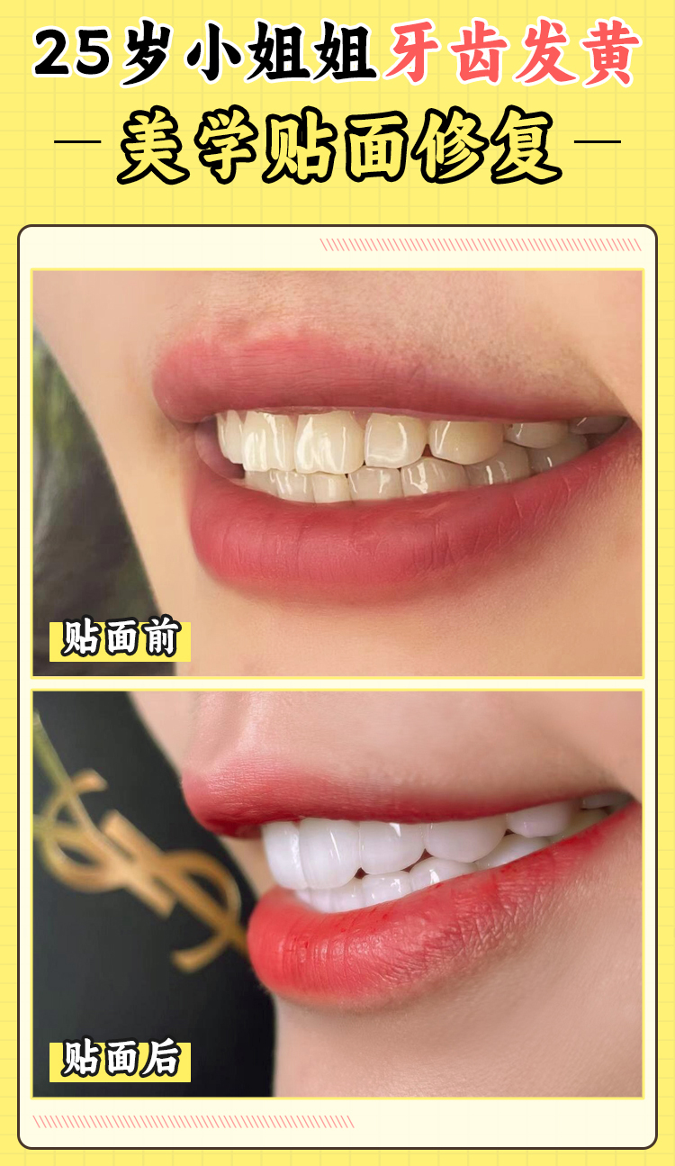 張棟梁醫(yī)生核心技術(shù)優(yōu)勢：從舌側(cè)矯正到不拔牙正畸，解鎖高難度矯正密碼