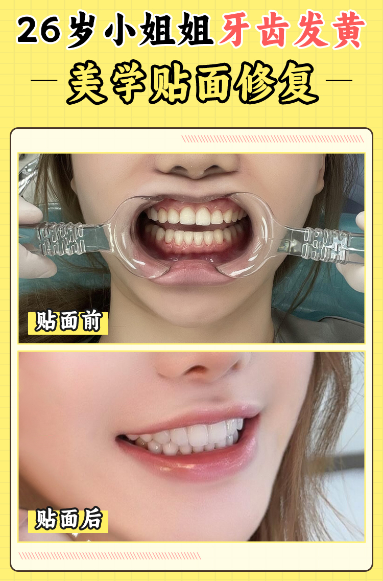 張棟梁醫(yī)生患者真實(shí)反饋：數(shù)萬例成功實(shí)例見證，正畸圈“零差評(píng)”是如何煉成的？