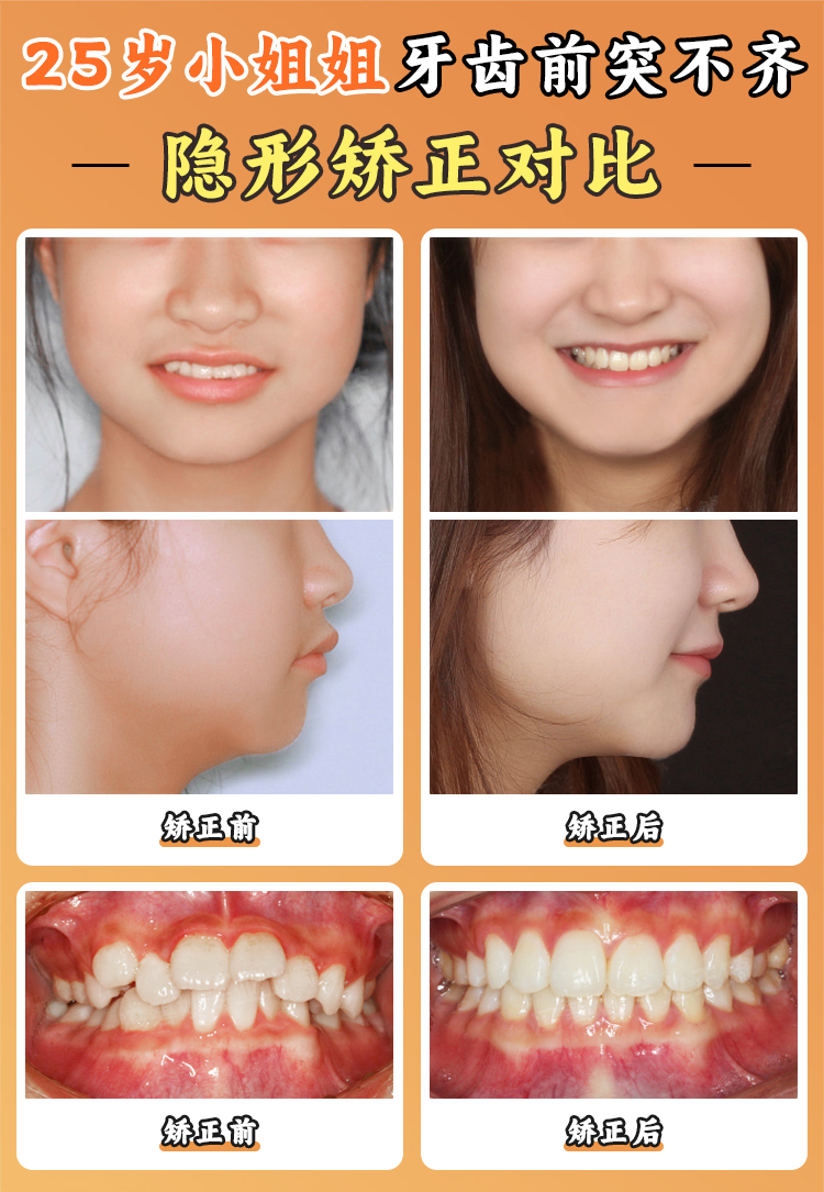 張棟梁醫(yī)生預(yù)約掛號(hào)攻略：號(hào)源緊張？3招教你“快速鎖定”骨干醫(yī)生號(hào)